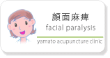 顔面麻痺