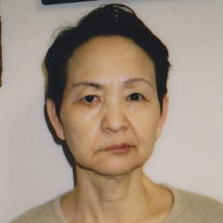 顔面麻痺治療例