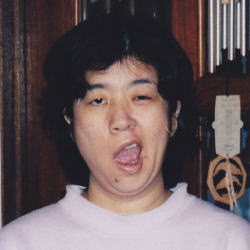 顔面麻痺治療例